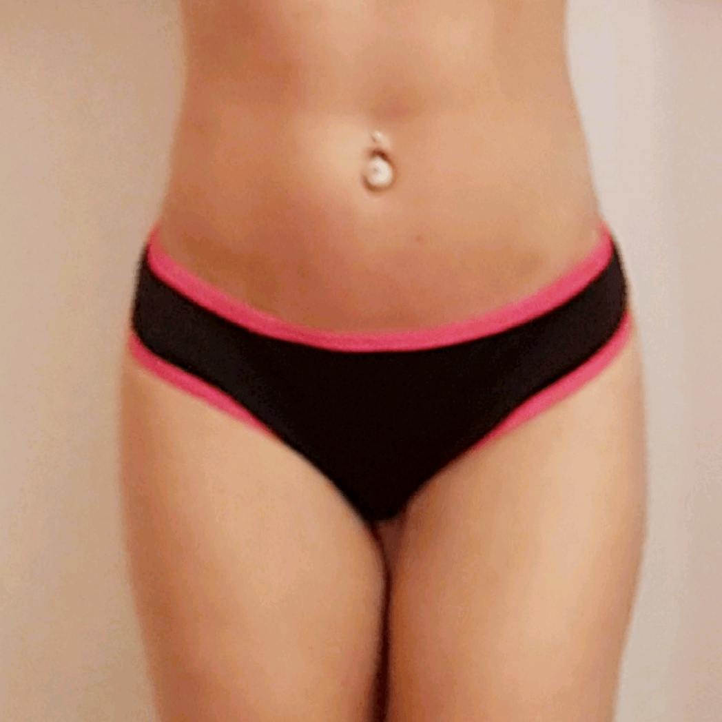 Slip summer-Slip-Flamingo pole wear